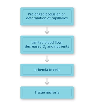 Mechanics of Pressure Injury