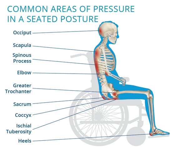 Common areas of pressure in a seated posture