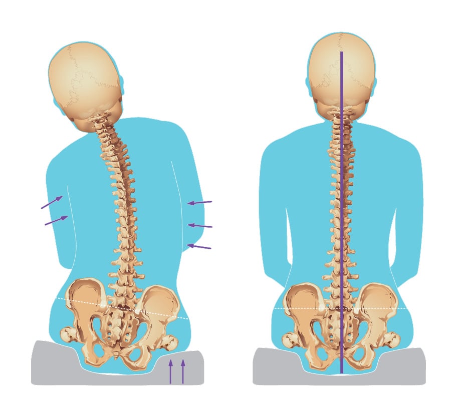 Cushion Considerations: Providing the Required Postural Support