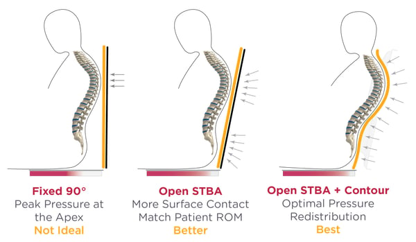 Ideal STBA