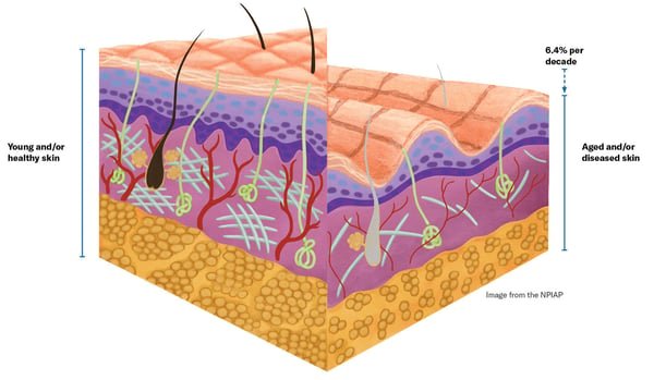 Young vs old skin