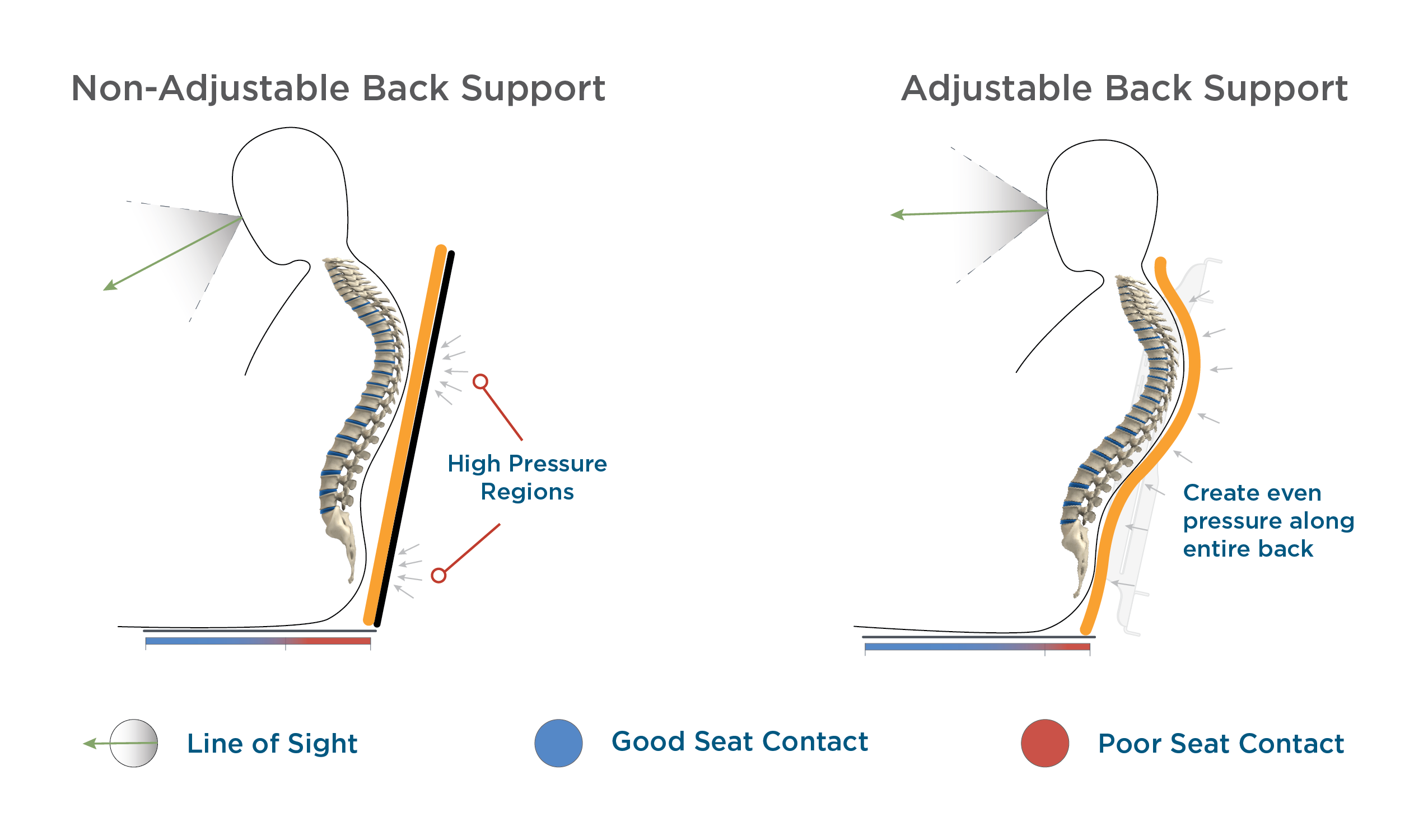 Issues With Current Wheelchair System: Back Support