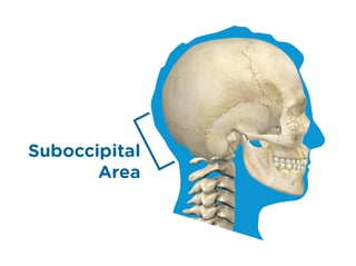 HeadSupportDiagram.png