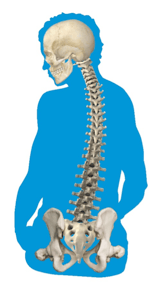 Pelvic Rotation: Symptoms & Treatment Through Wheelchair Positioning