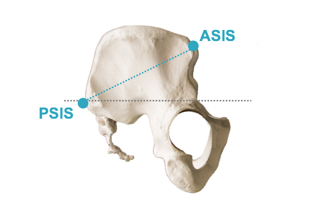 Posterior Pelvic Tilt - Pelvis.png