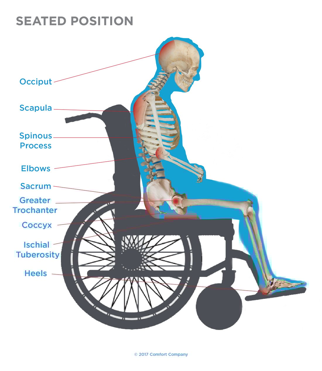 Postural Evaluation in Sitting Let Your Hands Mimic the Possibilities