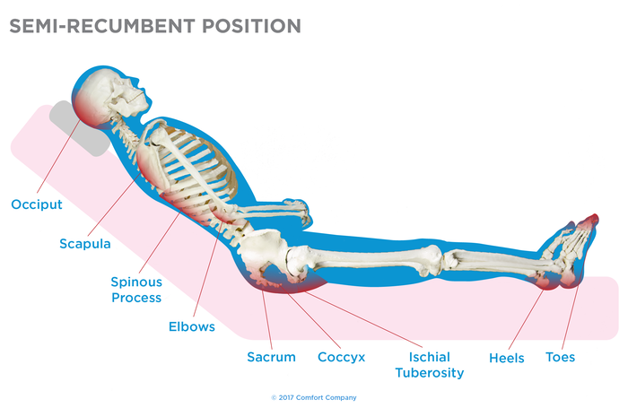Semi Recumbent Position Semi Recumbent Position