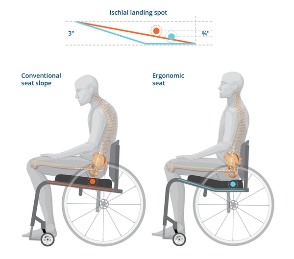 K0005 Ergo vs Conventional Seat Slope