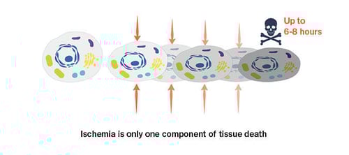 Ischemia tissue