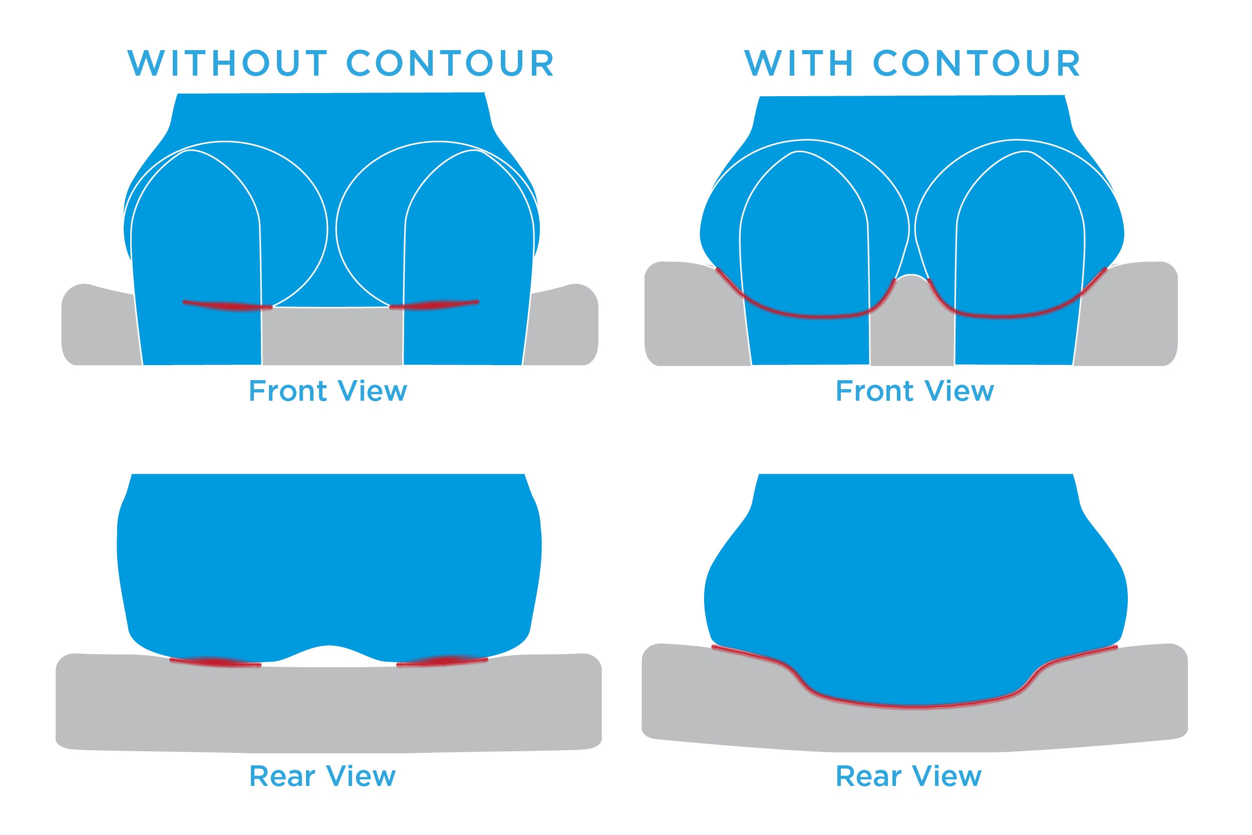 Contoured Surface Area Contact 