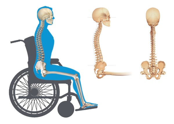 Neutral Pelvic Posture