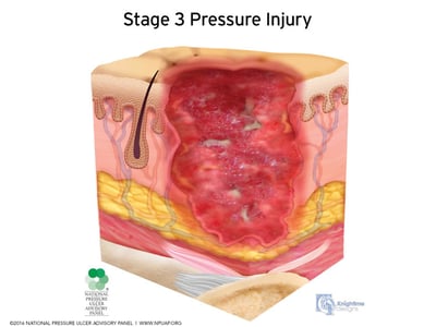 Wound Care Guide
