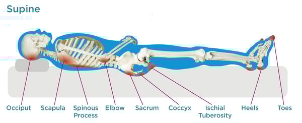 Положение фаулера картинка. C a d position. C a d position. Лежит на животе. Первая помощь при эпилептическом приступе.