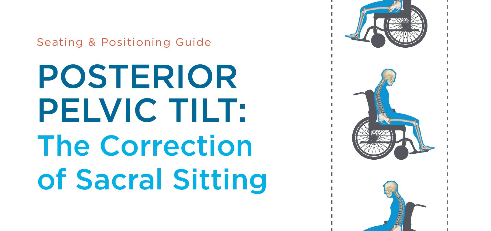 posterior pelvic tilt