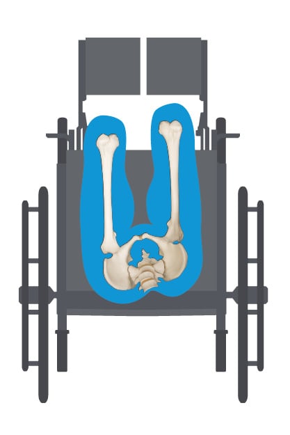 Quick Guide to Proper Wheelchair Positioning – Adult and pediatric  printable resources for speech and occupational therapists