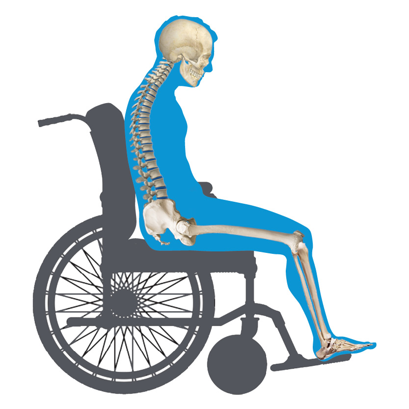 Posterior Pelvic Tilt Wheelchair View